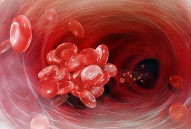 хипертония хипертония