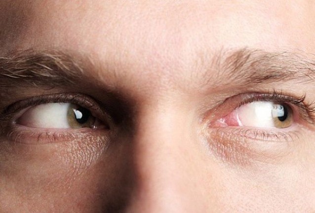 ретина ретина