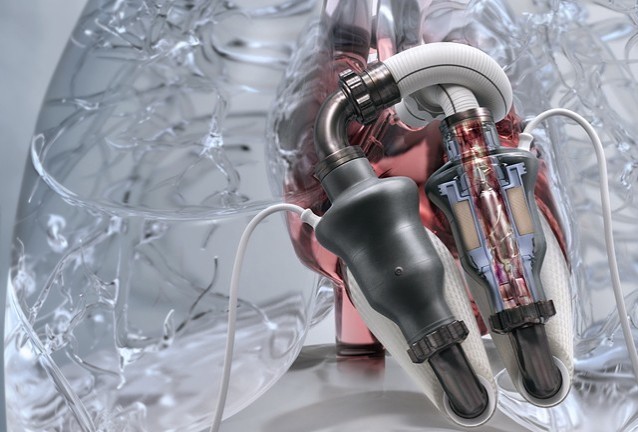 Изкуствено сърце