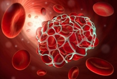 Кръвната група може да повлияе на риска от образуване на тромби